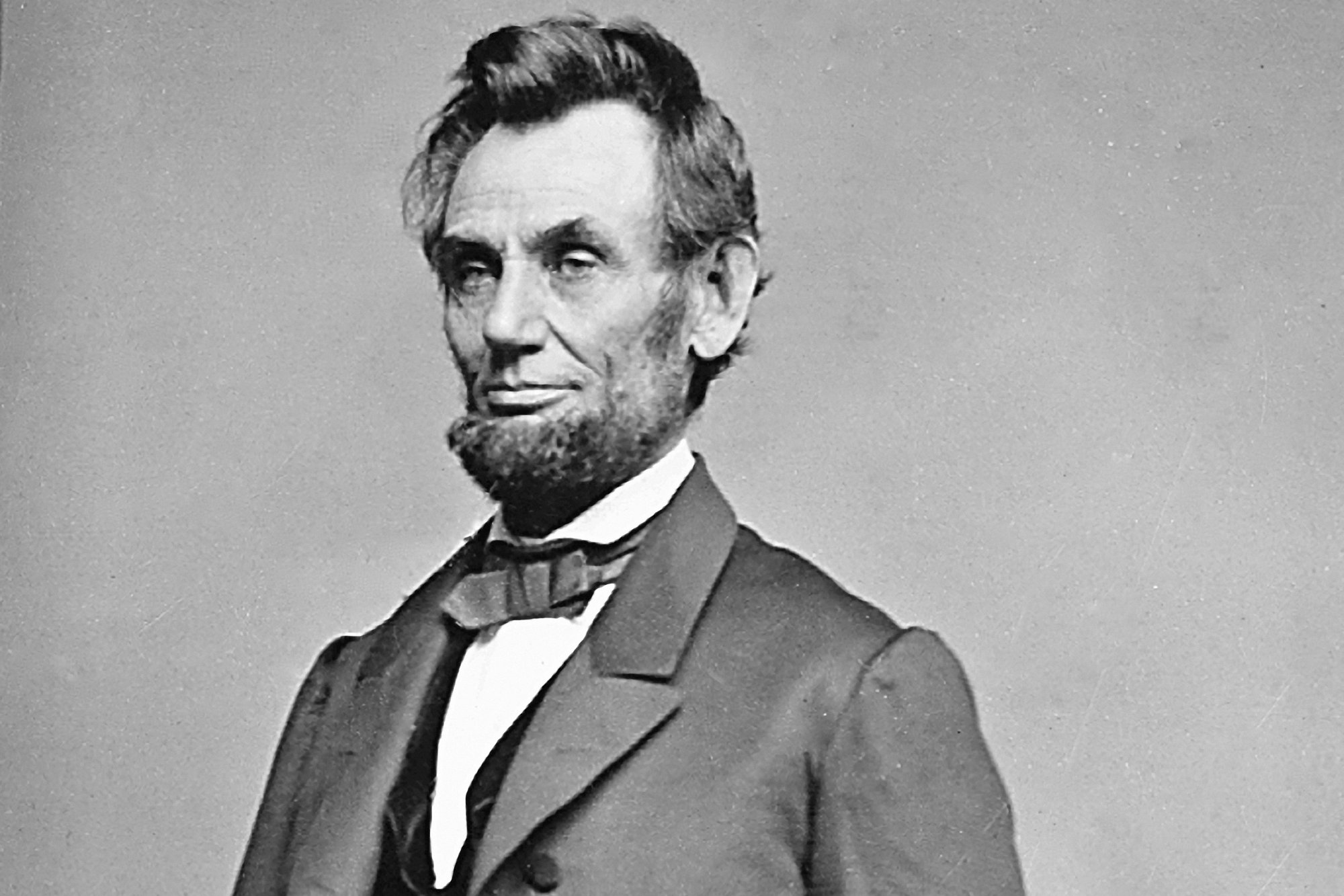 Famous People With Marfan Syndrome - Abraham Lincoln